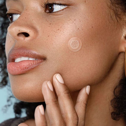 Hydrocolloid Acne Patches